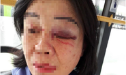 TP HCM: Nữ tiếp viên xe buýt bị khách đấm bầm mắt