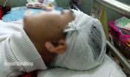 Sở GD-ĐT Thanh Hóa yêu cầu làm rõ trách nhiệm trong vụ nam sinh bị đánh vỡ sọ não