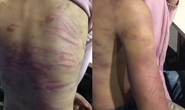 Điều tra vụ bé gái 12 tuổi bị mẹ đẻ cùng “người tình” bạo hành dã man