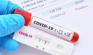Chỉ số CT rất thấp nhưng ho, sốt nhẹ 2 ngày rồi hết có còn nguy cơ trở nặng?