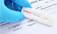 Test Covid-19 vào thời điểm nào trong ngày để chính xác gấp đôi?
