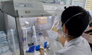 Sở Y tế TP HCM yêu cầu các đơn vị báo cáo khẩn việc mua kit xét nghiệm của Việt Á