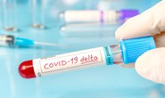 Covid-19: Chính biến thể Delta hé lộ nguồn gốc virus SARS-CoV-2?