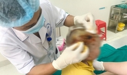 Bé 3 tuổi bị chó hàng xóm cắn trọng thương vùng đầu, mặt