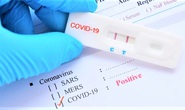 F0 tăng, UBND TP HCM chỉ đạo khẩn liên quan đến kit test nhanh