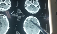 Vụ người dân tố bị đánh chấn thương sọ não: Có kết quả giám định ghi âm