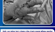 Người đàn ông đến bệnh viện với 2 ngón tay đứt lìa được ướp đá