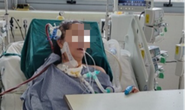 Lạm dụng corticoid tự điều trị cúm, nữ bệnh nhân 37 tuổi suy đa tạng
