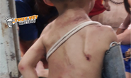 TP HCM: Xót xa hình ảnh bé trai chi chít vết thương nghi bạo hành