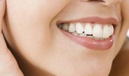 Bí kíp đơn giản giữ trắng răng