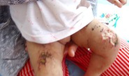 Khởi tố vụ hành hạ bé gái 9 tháng tuổi