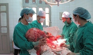 Mổ cắt thành công khối u nang nặng gần 19 kg