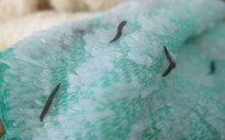 Ấu trùng lạ trong khăn tắm Trung Quốc