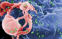 Tái phát HIV sau khi khỏi AIDS