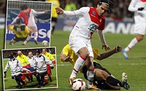 Falcao có nguy cơ chia tay World Cup 2014