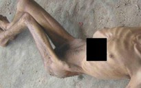 Lộ hình tra tấn tù nhân khủng khiếp tại Syria