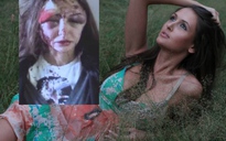 Người mẫu Nga bị bạn trai triệu phú đánh dã man