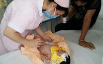 Trung Quốc bắt bác sĩ nghi giết trẻ sơ sinh hở hàm ếch