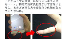 Ngón tay út bị biến dạng vì nghiện smartphone?