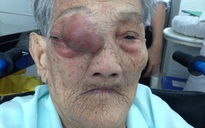 Cứu mẹ Việt Nam Anh hùng 101 tuổi bị khối u ép não