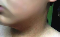 Phạt 2 triệu đồng thầy giáo hành hung nam sinh lớp 8