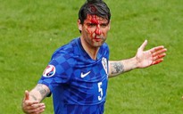 "Dính" cùi chỏ, hậu vệ Croatia đầu bê bết máu