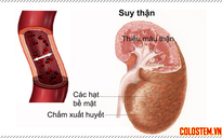 Lần đầu tiên chạy thận nhân tạo ở trạm y tế