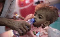 Nạn đói thế kỷ ở Yemen