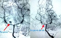 Căn bệnh hiếm gặp cực nguy hiểm ở trẻ nhưng không dễ phát hiện