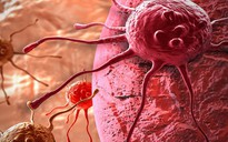 Phát hiện 2 protein ở da người tự hủy tế bào ung thư