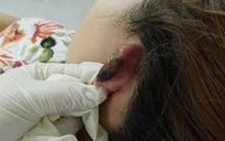 Cô gái bị chích điện, xẻo tai vì chậm trả 20 triệu đồng