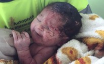 Văng khỏi bụng mẹ trong tai nạn giao thông, em bé sống sót kỳ diệu