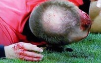 Trọng tài Europa League bị ném vỡ đầu, chảy máu bê bết