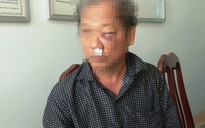 Phóng viên VTV bị hành hung dã man sau khi báo tin bắt "đất tặc"