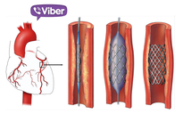 Kết nối Viber, cứu người đàn bà bị nhồi máu cơ tim trên xe