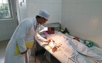 Lần đầu tiên ở ĐBSCL nối mạch máu vi phẫu không cần kim khâu