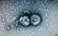 Virus gây bệnh Covid-19 ở Đà Nẵng lây lan nhanh hơn chủng cũ