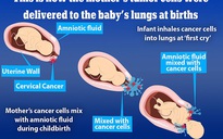 Sốc: 2 trẻ sơ sinh Nhật Bản hít phải tế bào ung thư từ mẹ