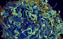 Kỳ diệu người phụ nữ tự loại bỏ HIV