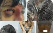 Siêu mẫu Khả Trang bị bạo hành đến "thân tàn ma dại'?
