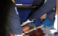Kinh hãi nam công nhân bị chém gần lìa cánh tay trong KCN Long Thành