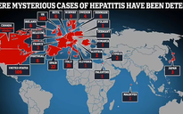 Bệnh viêm gan bí ẩn tiếp tục diễn biến phức tạp trên toàn thế giới