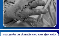 Người đàn ông đến bệnh viện với 2 ngón tay đứt lìa được ướp đá