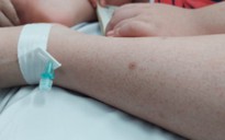 Chăm sóc trẻ mắc sốt xuất huyết tại nhà như thế nào?