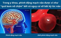 Người đàn ông bị phình động mạch não giữa kích thước "khổng lồ"