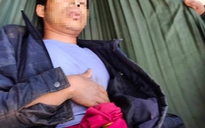 Nam thanh niên bị trâu húc thủng bụng