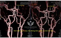 Ở Mỹ không phát hiện, về Việt Nam tìm ra bệnh hiểm