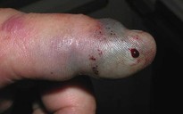 Nhiều người gặp nạn cùng thời điểm rắn độc đi kiếm ăn