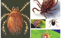 Ca sốt mò đầu tiên tại phía Nam: Nguy kịch chỉ vì một vết đốt