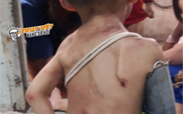 TP HCM: Xót xa hình ảnh bé trai chi chít vết thương nghi bạo hành